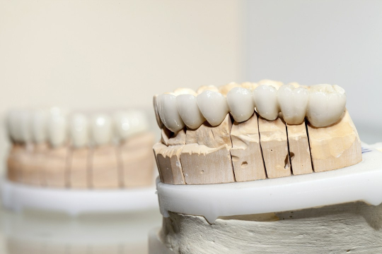 zęby porcelanowe