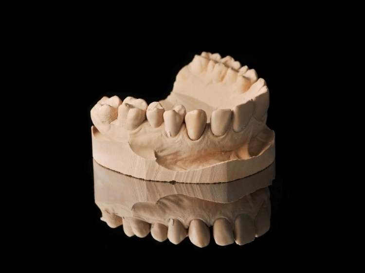 proteza zębów